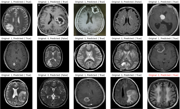 tumor prediction